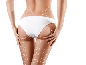 liposaksin_ameliyati-300x225-300x225