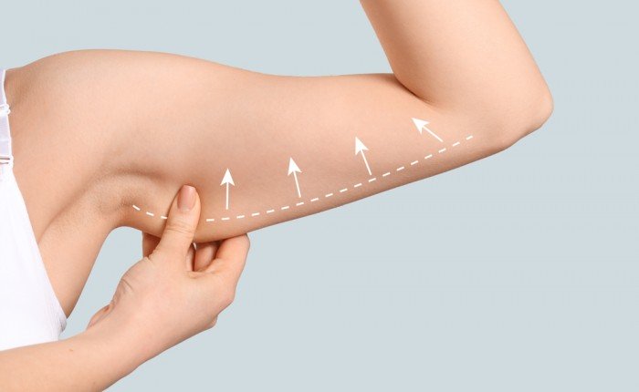 liposkulpturirovanie-oblasti-grudi-i-ruk-v-moskve-8785